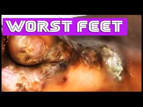 Infestation Video
