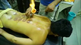 Neuro Panchkarma Therapy for slip disc treatment by Dr Yogesh Sharma, Sikar, Rajasthan (India)