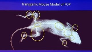 Genetic Mysteries Fop - When Bodies Turn To Bone