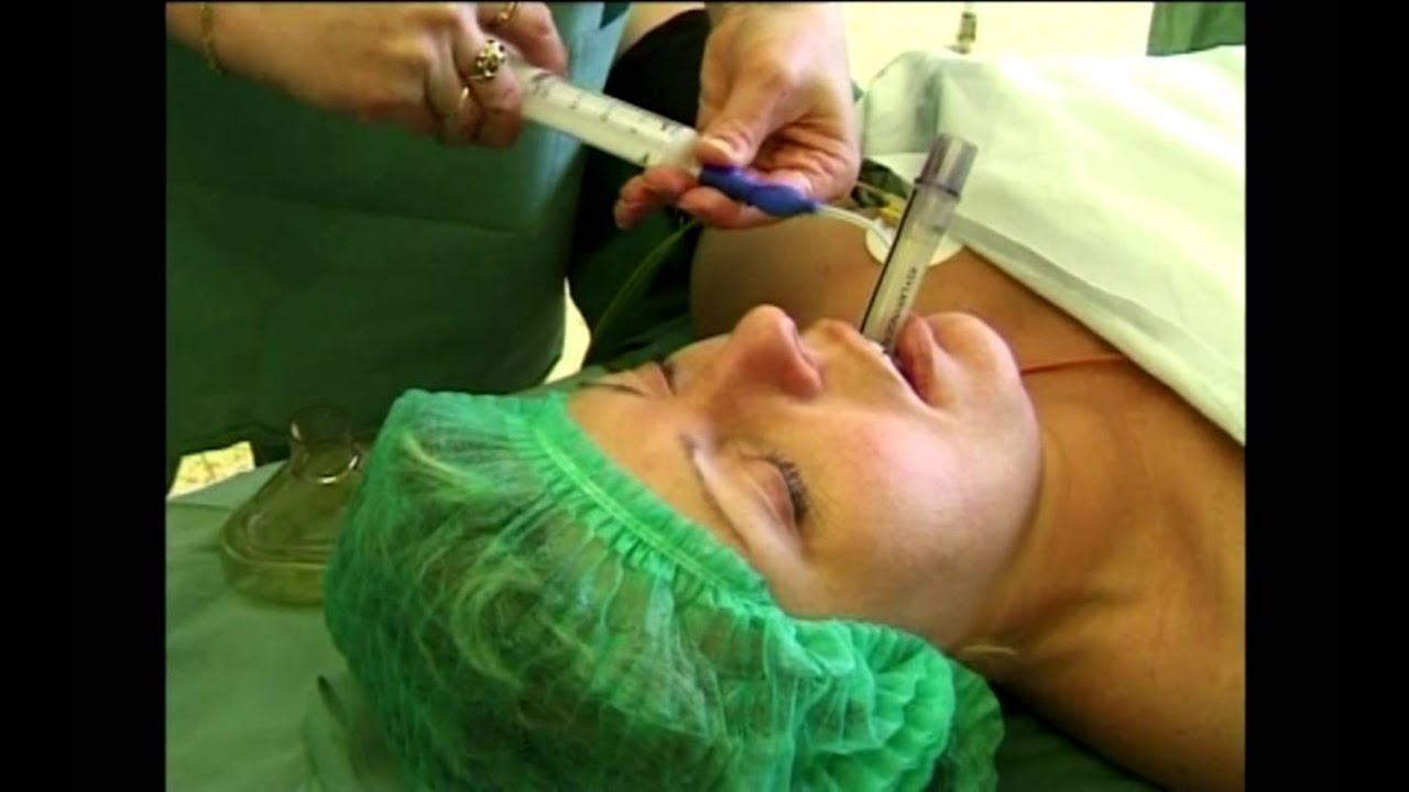 Mask anaesthetic orgasm table Father son domination