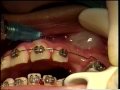 cirugía dental