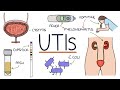 Understanding Urinary Tract Infections