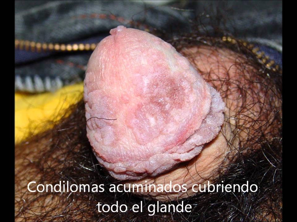 VIDEO MUJER CHUPANDO ANO video mujer chupando ano: