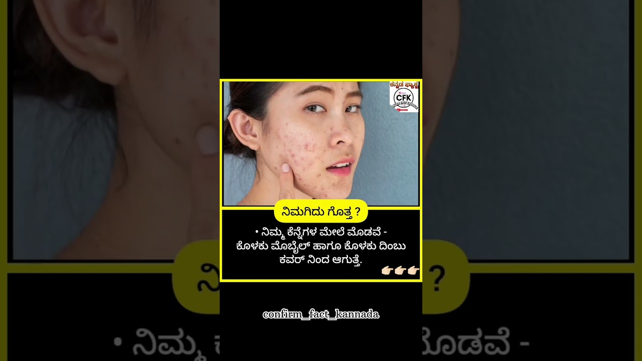 tips/fact kannada || pimples about || ಕನ್ನಡ | tips/fact kannada || pimples about || ಕನ್ನಡ |
