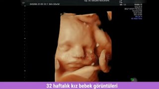 32 haftalık kız bebek görüntüleri, 4 boyutlu ultrason. Bebeğin cinsiyeti nasıl görünür, bebeğin yüzü