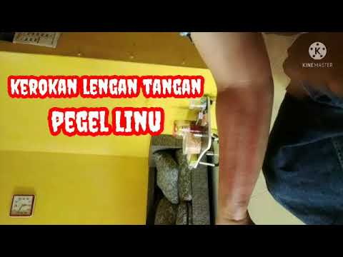 KEROKAN MERAH MERONA// LENGAN TANGAN