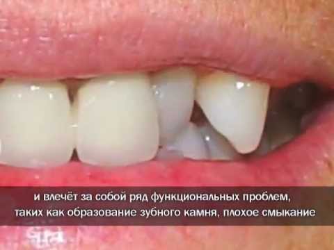 ЛУННЫЙ КАЛЕНДАРЬ РЫБАКА Лунный календарь Л. Толстой. Война и мир. Том 3. Часть 2