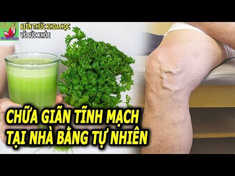 8 CÁCH CHỮA BỆNH GIÃN TĨNH MẠCH CHÂN TẠI NHÀ HOÀN TOÀN TỪ THIÊN NHIÊN