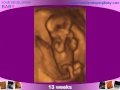 Watch the Baby Grow! Ultrasounds Week by Week During Pregnancy