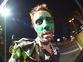 Strange Notes - Dude, Bro. Bro, Dude. Pt. 2