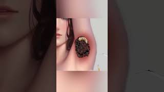 Underarm Deep Cleaning