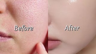 How To Shrink Open Pores Instantly & Permanently At Home Step-By-Step Routine