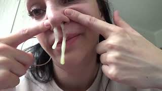 Nose Blowing Challenge Video Snotty