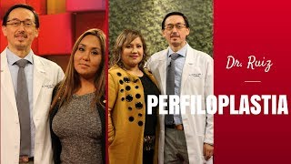 SIMULACIÓN DIGITAL DE UNA PERFILOPLASTIA