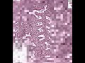 endometrium