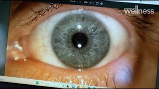 Exploring The Power Of Iridology By Unlocking The Secrets Of Your Health Through The Eyes