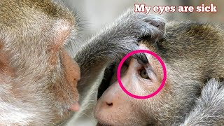 Great Eye Treatment, Nice Monkey Always Clean Treatment To Other Monkeys Eye.