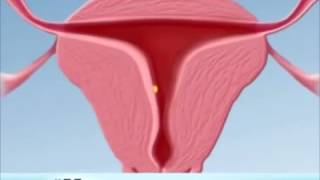 Pregnancy, problems, and solutions.... Pregnancy, problems, and solutions....