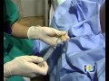 Anestesia epidural para el parto. Creado por el Hospital Universitario de Guadal