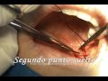 cirugía dental