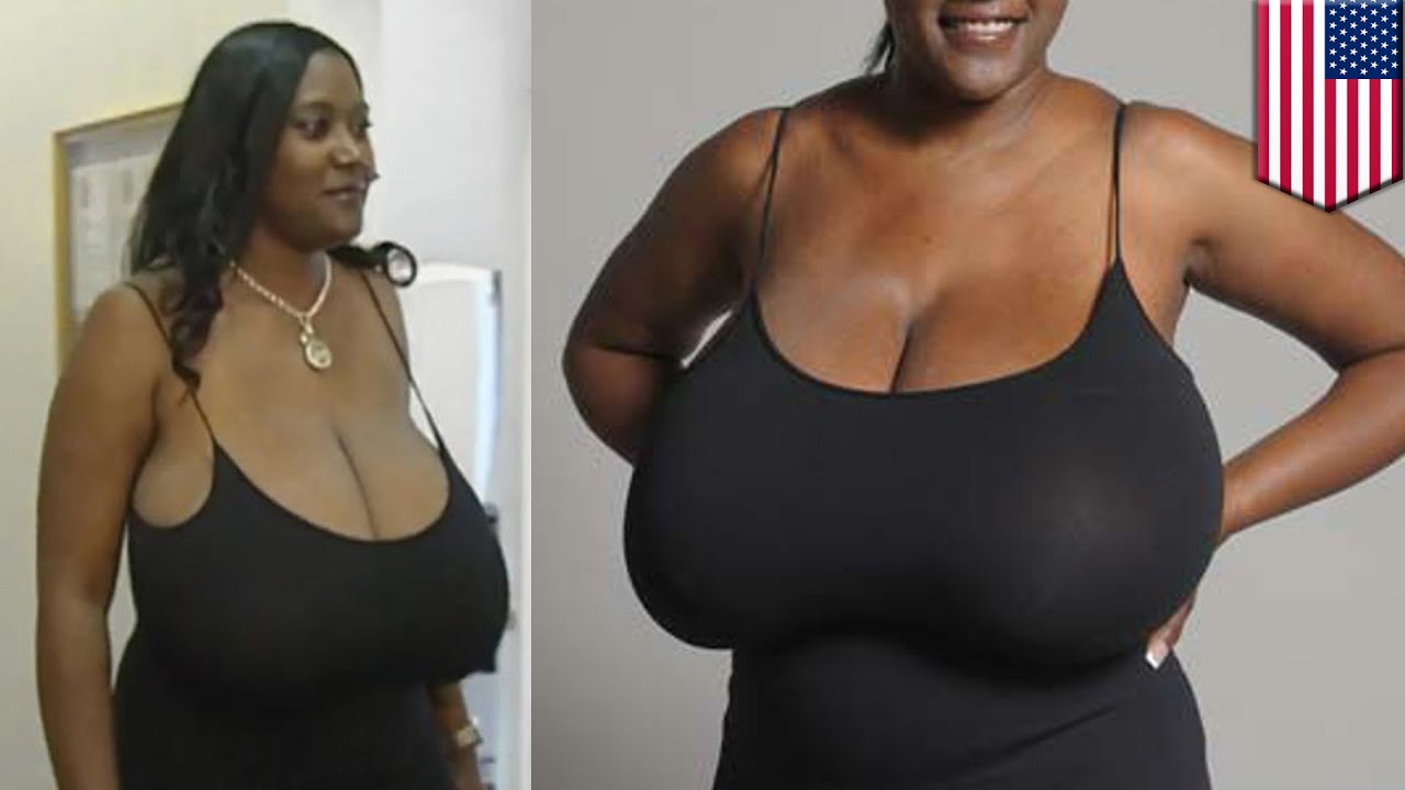 Boob reduction surgery