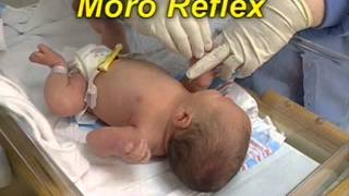 Motor Skills: Reflexes HQ Motor Skills: Reflexes HQ