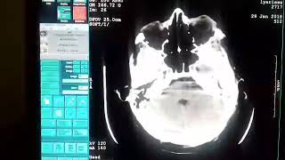 Mom Charity Run, Igor Kretov - Brain Computer Tomography
