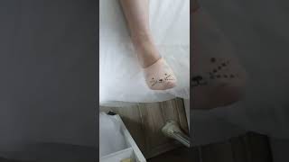 Buz Lazer Epilayon Nedir? Nasıl Yapılır?