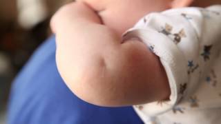 Cook Children's - El asma sin diagnosticar