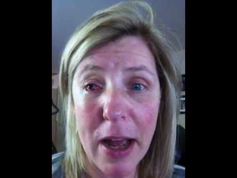 Treatment strabismus adults congratulate Tell Treatment strabismus adults thanks And