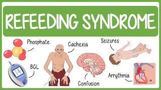 Refeeding Syndrome Visually Explained