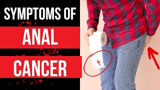 Doctor explains SYMPTOMS OF ANAL CANCER - plus risk factors, diagnosis and treat