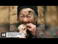 20 Bizarre People With Extra Body Parts