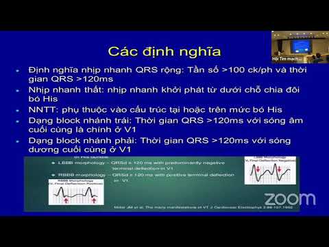 Điện tâm đồ (buổi 9): Nhịp nhanh với QRS rộng