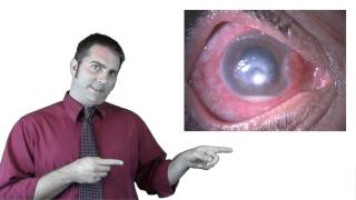 Halloween Contact Lenses: Tips from an Eye Doctor