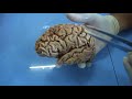 Cerebrum