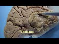 Cerebrum