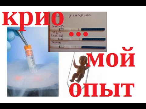 Поддержка крио на ЗГТ Поддержка крио на ЗГТ