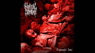 Watch Mental Demise Soporific Anabiosis video