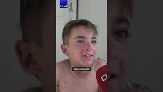 Bülloz Pemfigoid Adlı Deri Hastalığı Bulunan Yaşar Zor Günler Geçiriyor
