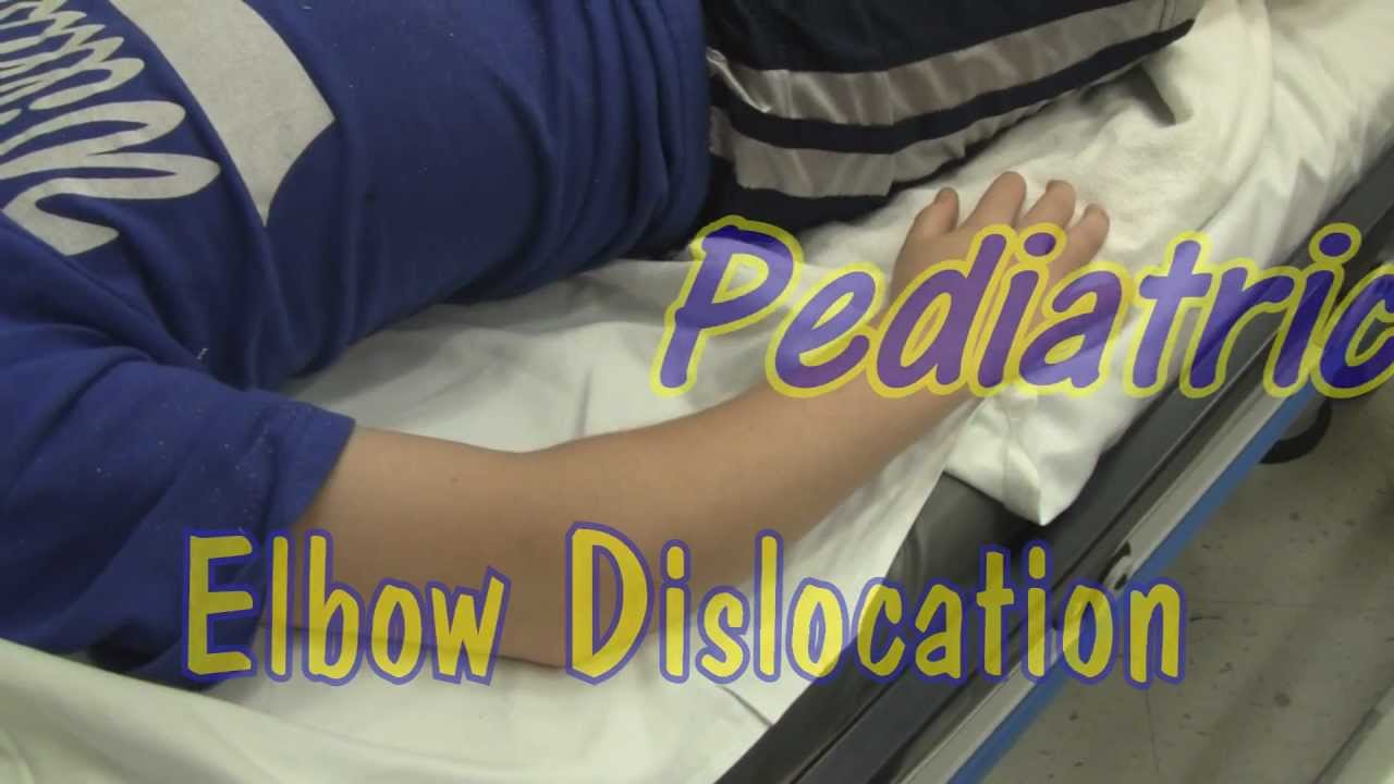 pediatric elbow dislocation youtube i want to be a nurse