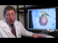 Penectomy