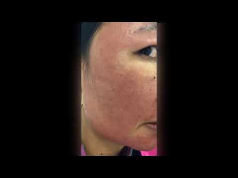 Tác Hại Khó Lường Của Kem Trộn