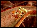 Understanding Cholesterol (Heart Basics #5)