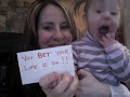 Down's syndrome