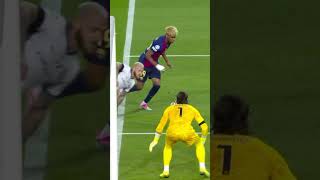 The Skill Of The Save?