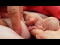 Help For Tiny Sphynx Kitten to Nurse 💞 Emotional Moments