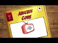 Part 1 - Abscess Core Removal