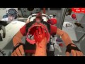 Surgeon Simulator 2013: Meet The Medic (DLC)