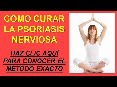 Que tal la eccema sobre la cabeza y como de curarle